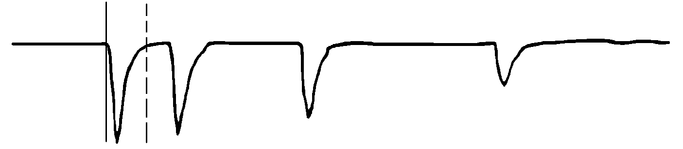 遠(yuǎn)端有短接線的波形 遠(yuǎn)端有短接線的波形